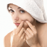 natural-acne-treatment
